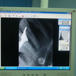 Clínica Dental Dra. Virginia Castro Rodríguez radiografía
